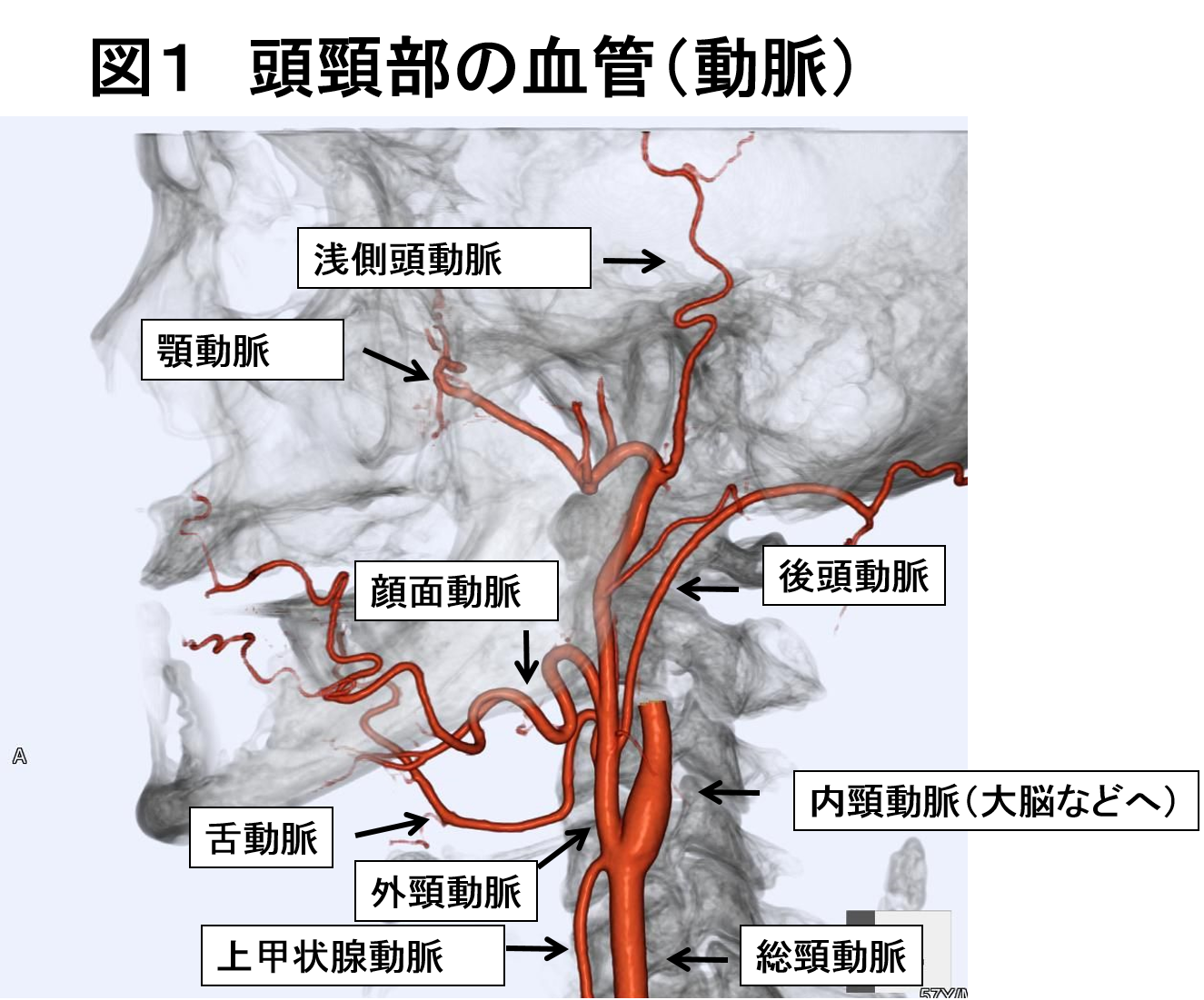 図１ 頭頸部の血管（動脈）